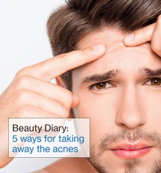 Beauty Diary: 5 ways for taking away the acnes